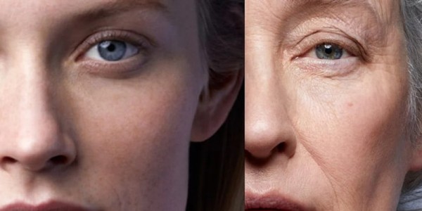 Ρυτίδες και Γήρανση.